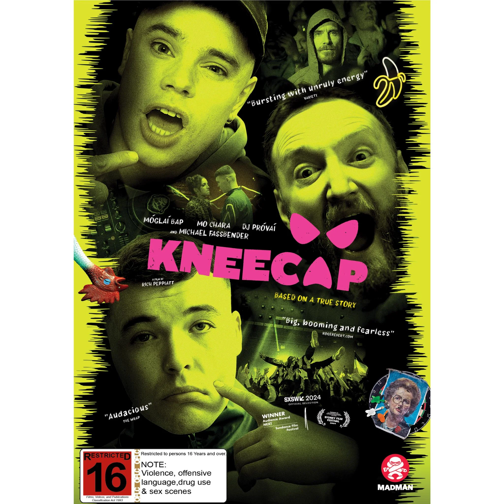 Kneecap