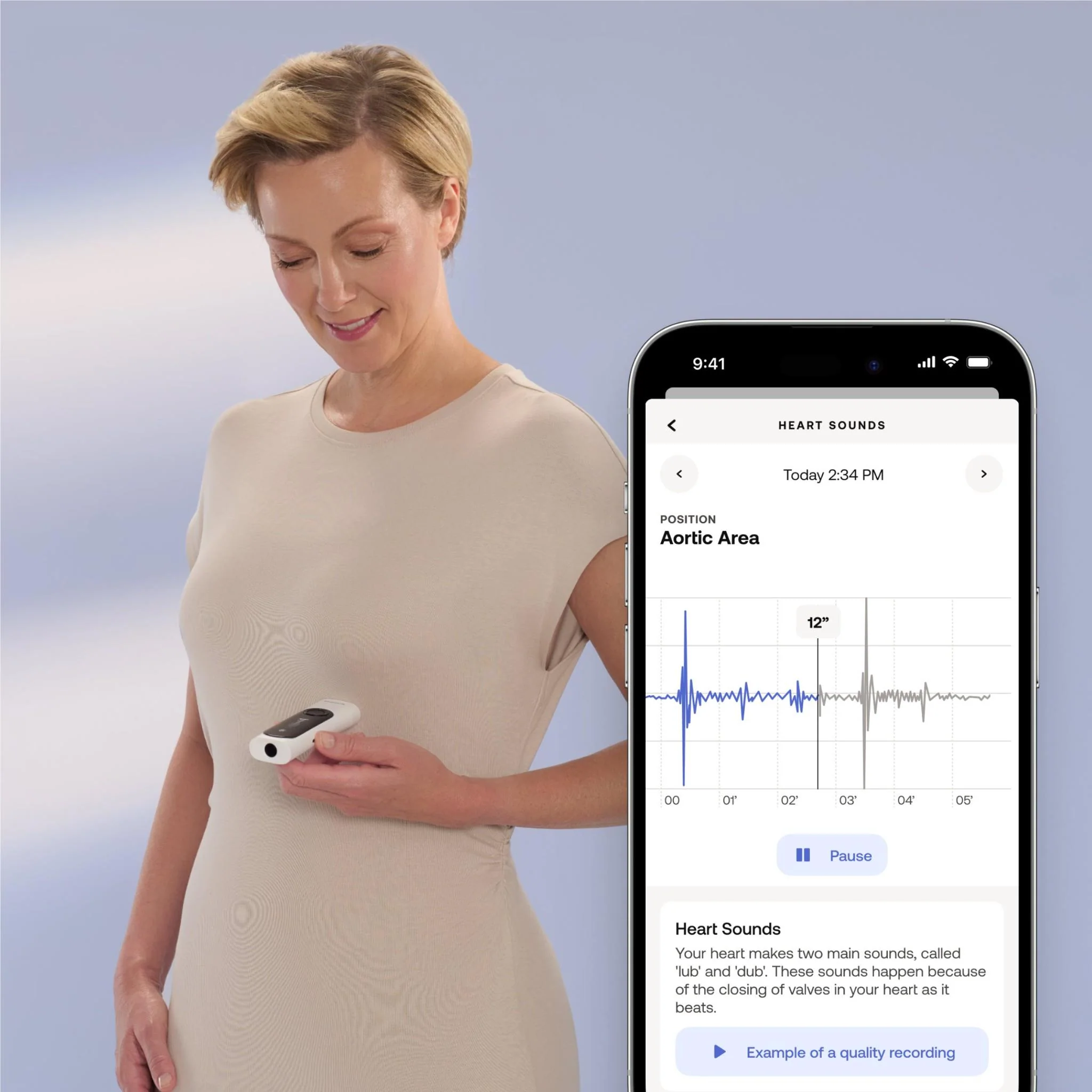 Withings BeamO 4-in-1 Multiscan Device - Image 8